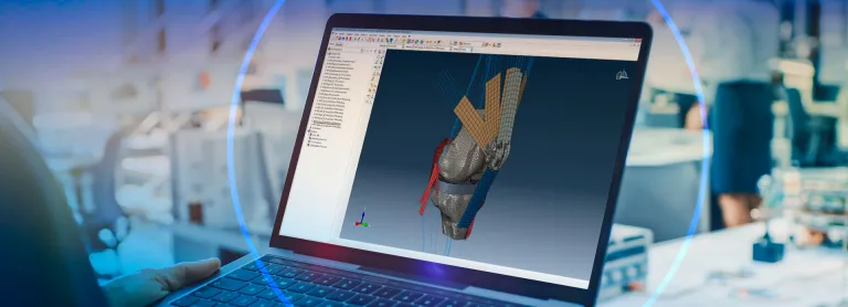 Abaqus Knee Simulator > Dassault Systèmes