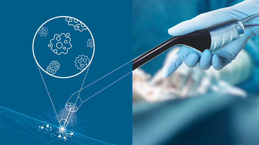 Surgeon using TRIOP intraoperative probe developed by Beams to define brain tumor margins with 3DEXPERIENCE platform support