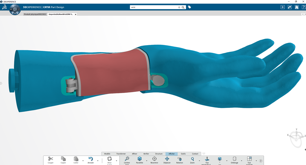 Biomodex's arm implant with 3D printing