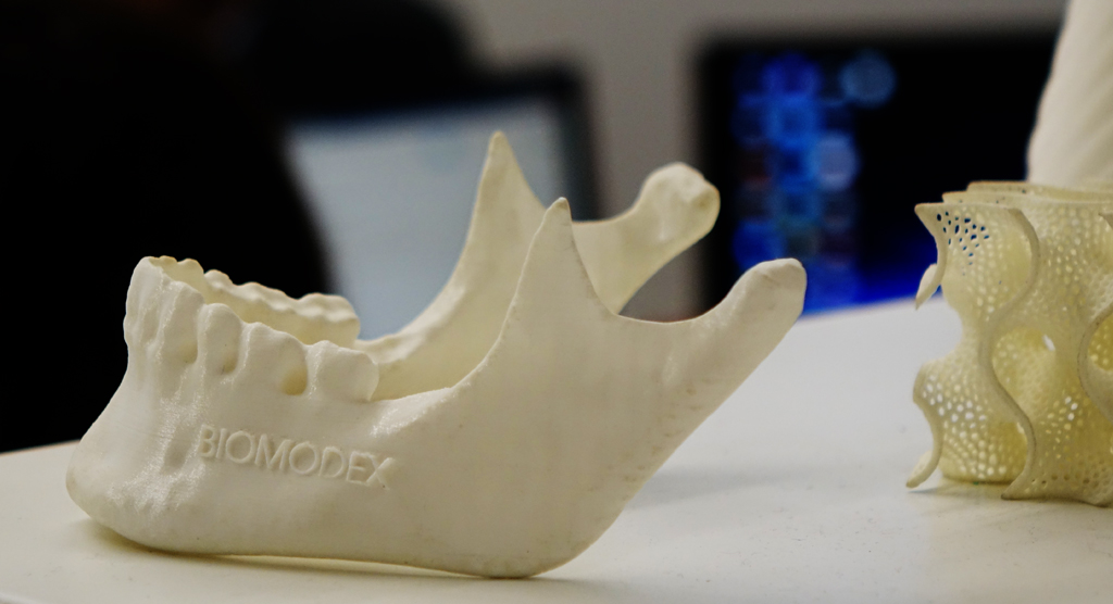 Biomodex implant for safer surgical planning