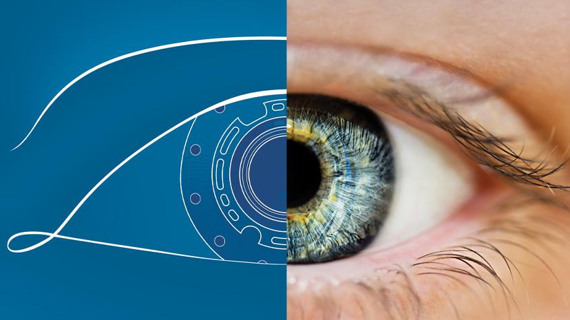 CorNeat Vision innovating with biomimicry to launch a new era in medical technology > Dassault Systèmes