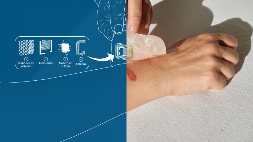 Grapheal, accélérée par le 3DEXPERIENCE Lab, développe des biosenseurs portables avancés pour le suivi continu à distance des plaies