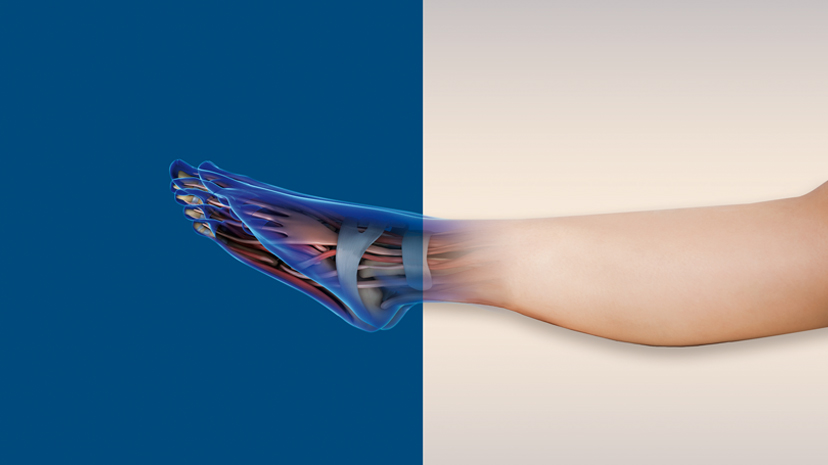 Digital Orthopaedics révolutionne les soins orthopédiques grâce à la modélisation 3D virtuelle