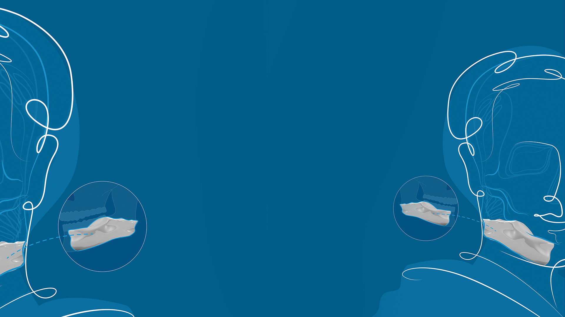 LUCID Implants crée des implants chirurgicaux personnalisés pour améliorer la qualité de vie des patients > Dassault Systèmes