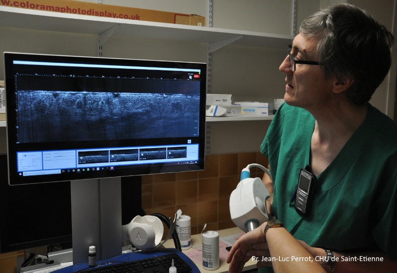Pr. Jean-Luc Perrot using handheld LC-OCT skin imaging device for non-invasive 3D optical biopsy during dermatological exam