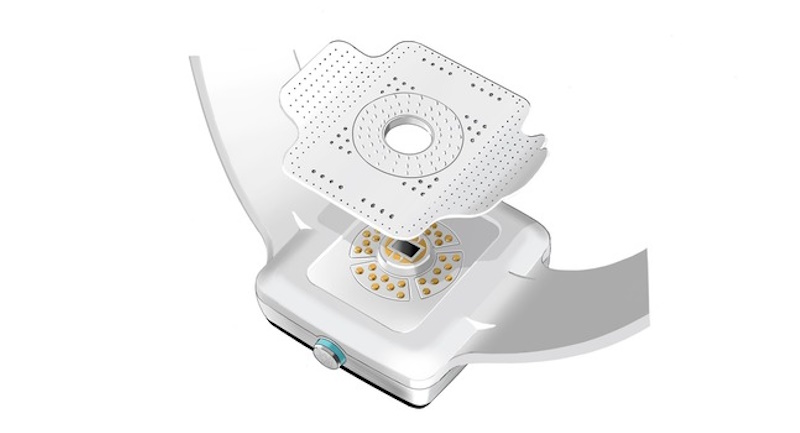 Smartwatch displaying PKvitality’s K’Watch continuous glucose monitoring system using microneedle skin patch.