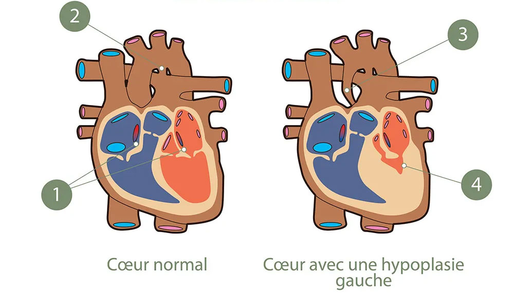 Circulation cardiovasculaire fœtale/néonatale