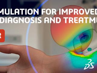 Don't miss out: SIMULIA BioEM Simulations for Medical Tech Webinar