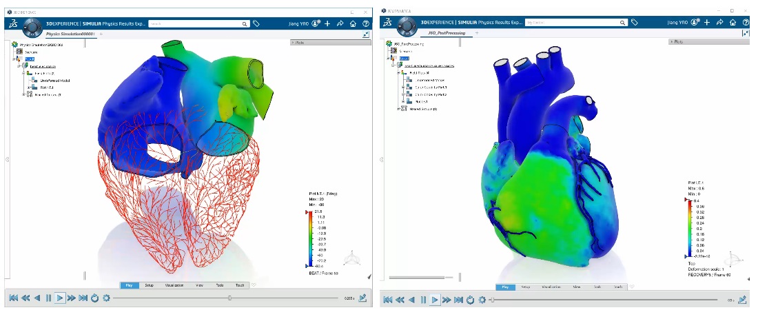 3D simulation of a human heart on the 3DEXPERIENCE platform for cardiovascular research and medical innovation