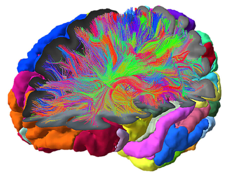 Virtual twin of brain