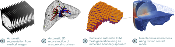 Modélisation en oncologie
