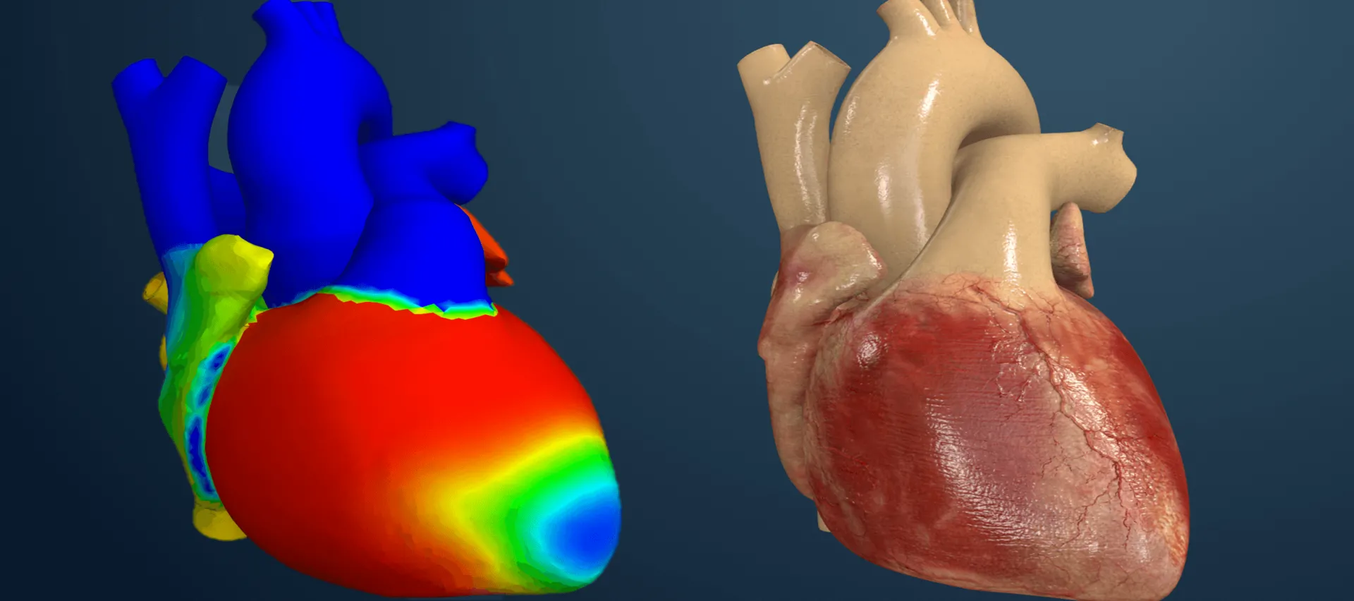 Dassault Systèmes and FDA Extend Collaboration for Cardio Devices