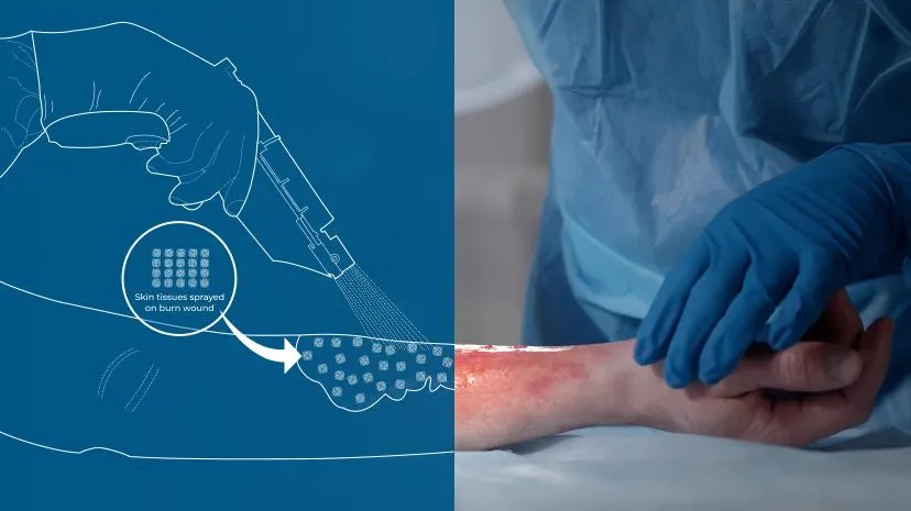 Visuel principal de Pacify Medical