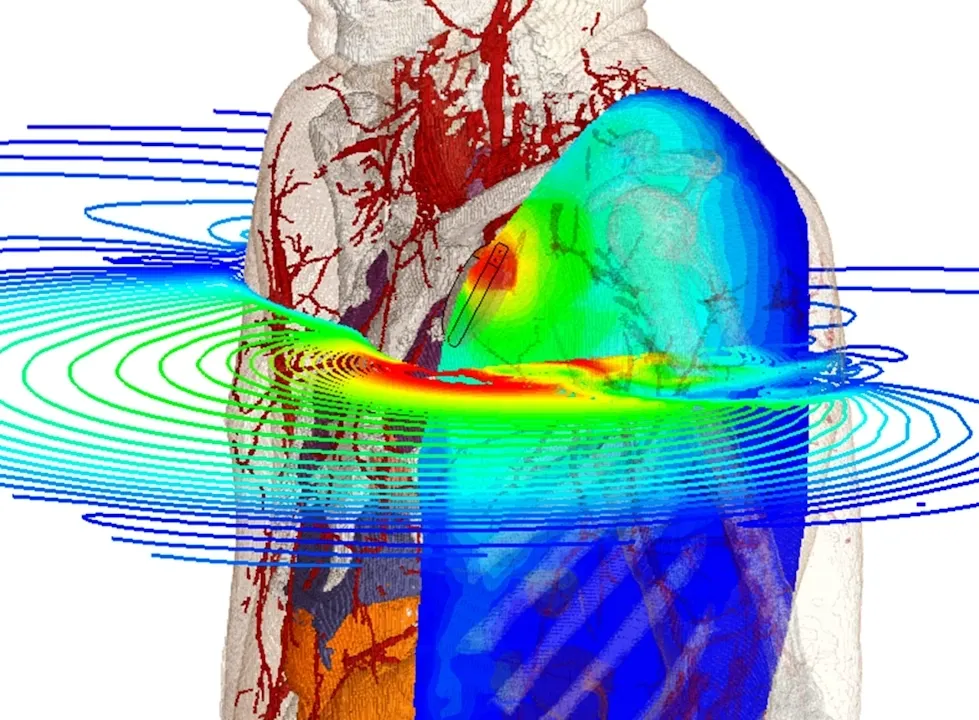 Bioelectromagnetics pacemaker > Dassault Systemes