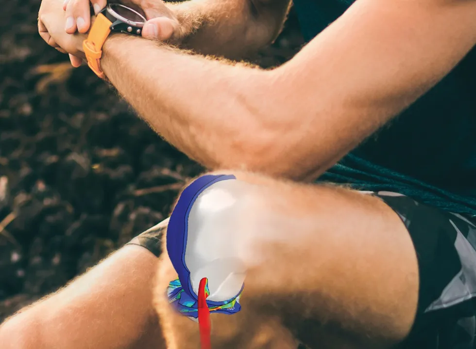 Orthopedic implant design visualization showcasing personalized medical devices for enhanced patient care