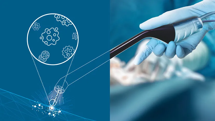 Surgeon using TRIOP intraoperative probe developed by Beams to define brain tumor margins with 3DEXPERIENCE platform support