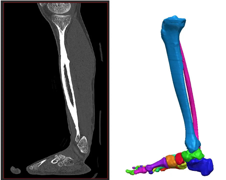 Digital Orthopaedics