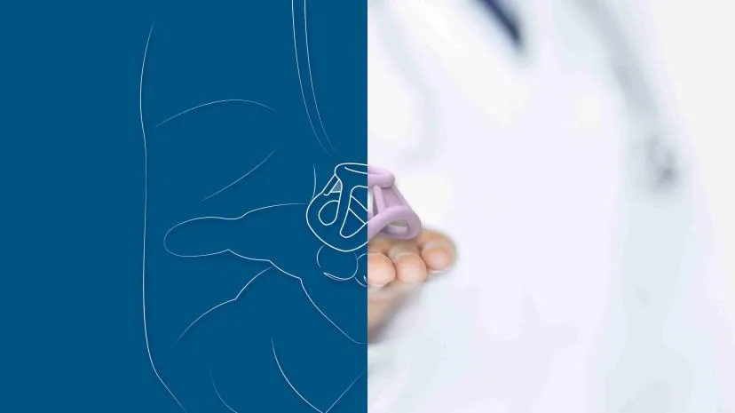 FemTherapeutics, plateforme gynécologique pour des prothèses personnalisées et non invasives