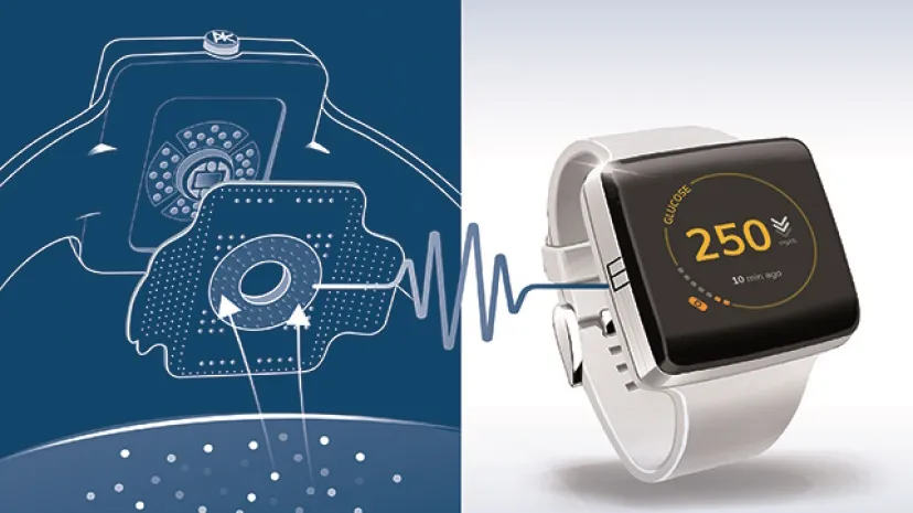 Smartwatch with PKvitality’s K’Watch CGM system featuring a discreet glucose-monitoring patch