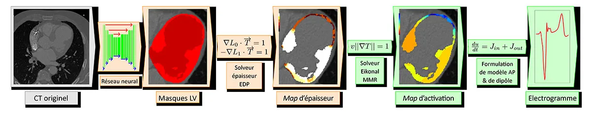 Du CT aux simulations: pipeline automatisé (segmentation par IA, calcul d'épaisseur, simulations de cartes d'activation, simulation d'ECG) 