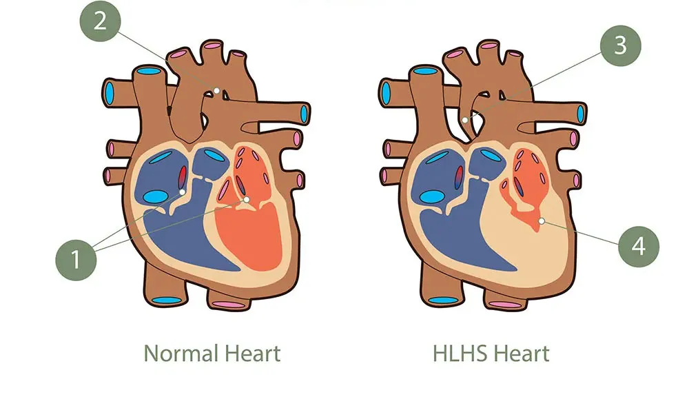 Fetal cardiovascular circulation