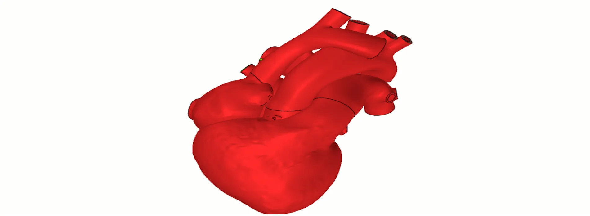 Living Heart Model > Dassault Systemes