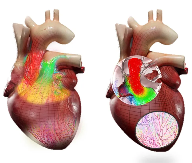 heart-with-aortic-flow.jpg.