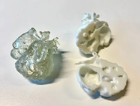 3DPrint of a sick baby "HLHS" heart, a project supported by the 3DEXPERIENCE Lab