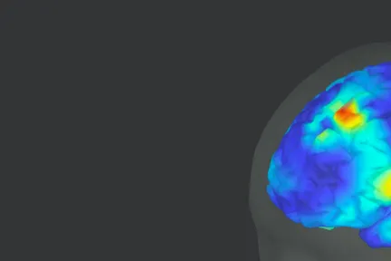 Le Living Brain dans la Chirurgie de l'Epilepsie