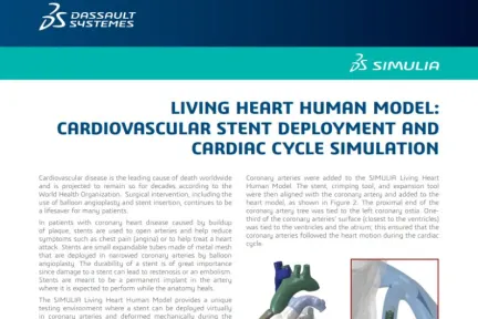 LIVING HEART HUMAN MODEL: CARDIOVASCULAR STENT DEPLOYMENT AND CARDIAC CYCLE SIMULATION