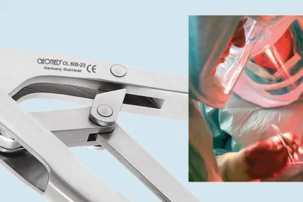 GEOMED Accelerates Development of Medical Instruments with Better Collaboration and Communication