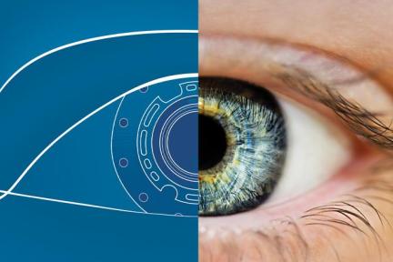 CorNeat Vision