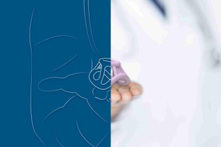 FemTherapeutics