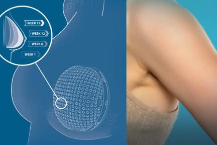 LATTICE MEDICAL