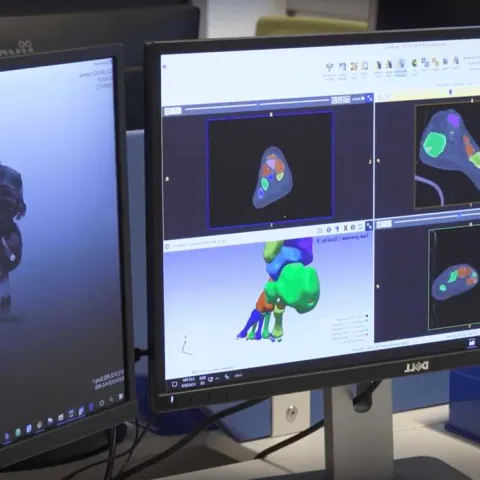Digital Orthopedics