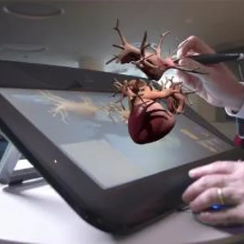 Projet Living Heart