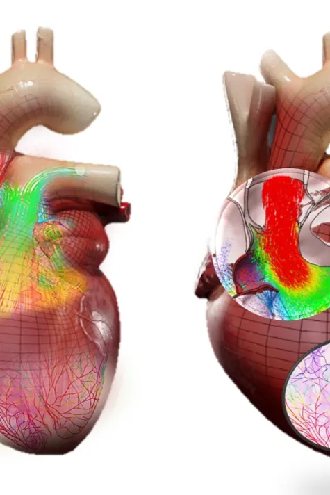ダッソー・システムズ、リビング・ハート・プロジェクトにAIを活用した