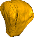 Abaqus Eulerian-Langrangian simulation of an automotive airbag for passenger safety
